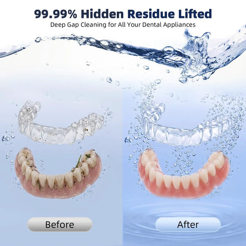 Powerful 45kHz Ultrasonic Cleaner For Dentures, Aligners, And Mouth Guards With UV Sanitizer showing before and after cleaning results.