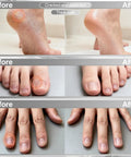 Before and after photo showcasing foot and hand transformations using Cordless Electric Nail File Drill With Rugged 2000 Mah Battery And Bright Led Lamp Real Deal Professional Manicure Pedicure Kit Featuring Ten Heavy Duty Grinding Heads For Gel Polish Removal Callus Buffing And Zero Hassle Salon Vibes At Home.
