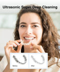 Woman holding aligner and before-after cleaning shots - Retainer Cleaner Machine With 45kHz Ultrasonic Cleaning And LED Digital Timer 200ml Capacity For Dentures Aligners Braces Toothbrush Heads And Jewelry Gunk Busting Tartar Removal Deep Clean At Home