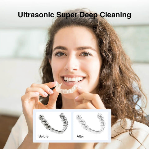 Woman holding aligner and before-after cleaning shots - Retainer Cleaner Machine With 45kHz Ultrasonic Cleaning And LED Digital Timer 200ml Capacity For Dentures Aligners Braces Toothbrush Heads And Jewelry Gunk Busting Tartar Removal Deep Clean At Home