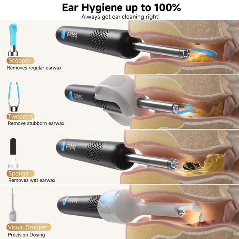 Ultra Ear Wax Removal Kit With Camera Ear Scope 10MP Lens And 3X Magnification showing cleaning tools and ear anatomy