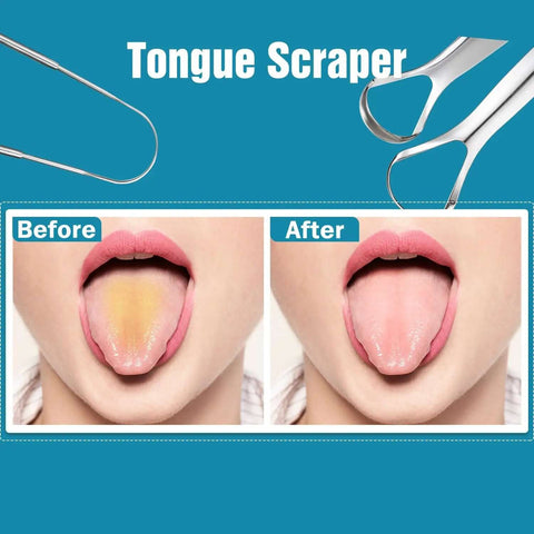 Three Piece Metal Tongue Scraper Set For Adults With Dual Handle Design Stainless Steel Tongue Cleaners demonstrating before and after use.