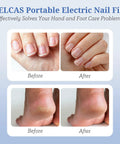 Before and after images showing results of PELCAS Portable Electric Nail File on hands and feet, illustrating effective nail care.