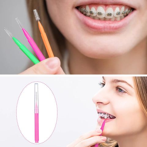 Person using Interdental Brush And Toothpick Kit For Braces 100 Pack In Bright Colors With 11 Mm And 13 Point 5 Mm Sizes