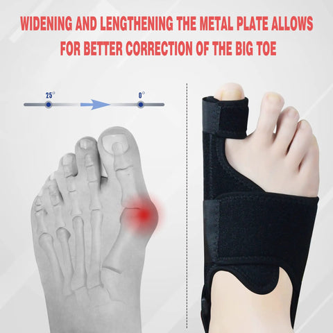 Overnight Bunion Corrector For Men And Women showing big toe straightener night splint with memory steel plates for pain relief