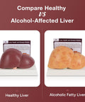 Hella Realistic Silicone Liver Anatomy Set Featuring Three Straight Up Life Size Medical Teaching Models With Normal And Fatty Liver Versions. Healthy vs Alcoholic liver comparison.