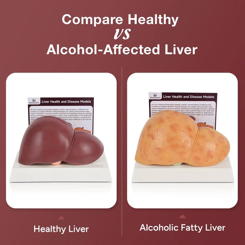 Hella Realistic Silicone Liver Anatomy Set Featuring Three Straight Up Life Size Medical Teaching Models With Normal And Fatty Liver Versions. Healthy vs Alcoholic liver comparison.