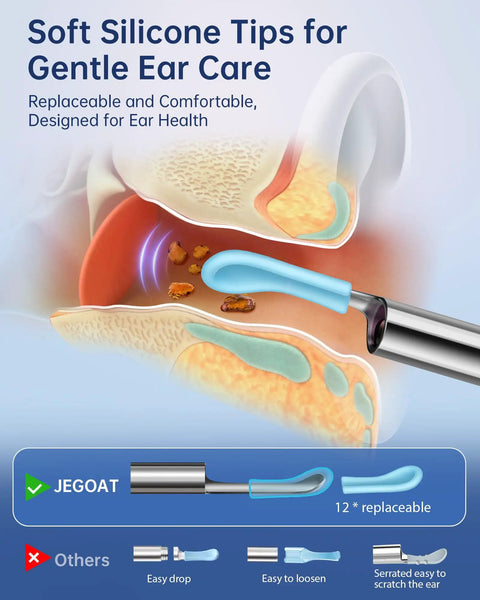 Illustration of Ear Wax Removal Tool With Camera 1296P HD Otoscope and soft silicone tip in ear canal