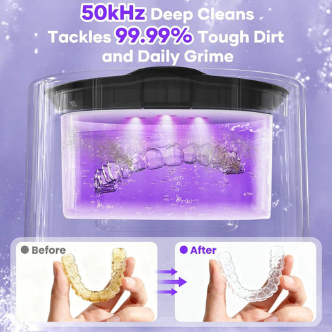 Retainers And Aligners Ultrasonic Cleaner 50kHz Dental Pod Deep Clean No Scrub Needed For Invisalign Braces Dentures Night Guards