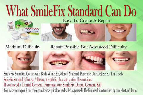 DIY At Home Dental Repair Kit For Missing Or Damaged Teeth With Color Matching Compound instructions and results.
