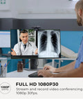 Top Tier 1080P Usb Webcam With Slick Privacy Shutter Dual Onboard Mics For Live Streaming Video Calls Gaming And Remote Hustle Quick Plug And Play Ready Setup in a medical video call setup.