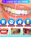 Before and after smiling teeth, plaque and tartar removal effects, Six Piece At Home Dental Hygiene Kit overview with benefits icons