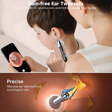 Ultra Ear Wax Removal Kit With Camera Ear Scope 10MP Lens And 3X Magnification in use for child's ear examination.