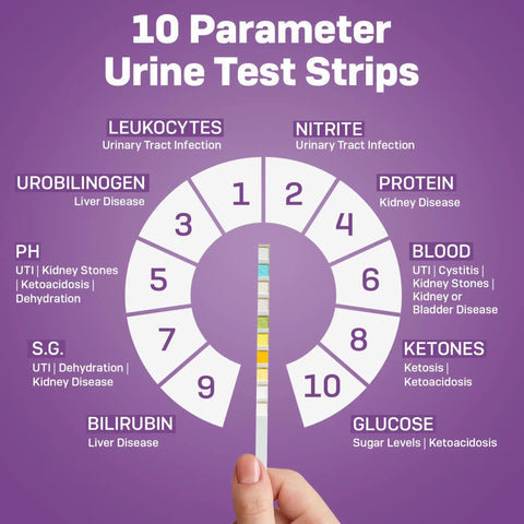 10 Parameter Urinalysis Test Strips For Pets A Complete Urine Test Kit For Dogs And Cats Including Leukocytes Glucose Bilirubin Ketones Specific Gravity Blood pH Protein Urobilinogen And Nitrite, 10-strip chart