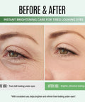 Before and after comparison of using Top Shelf Peptide Eye Cream That Hits Different For Dark Circles And Fine Lines.
