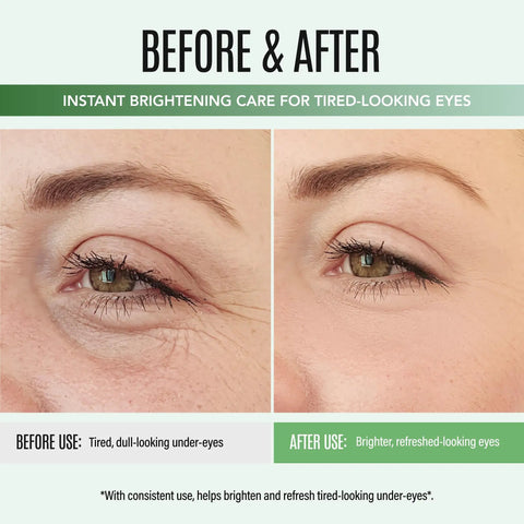 Before and after comparison of using Top Shelf Peptide Eye Cream That Hits Different For Dark Circles And Fine Lines.