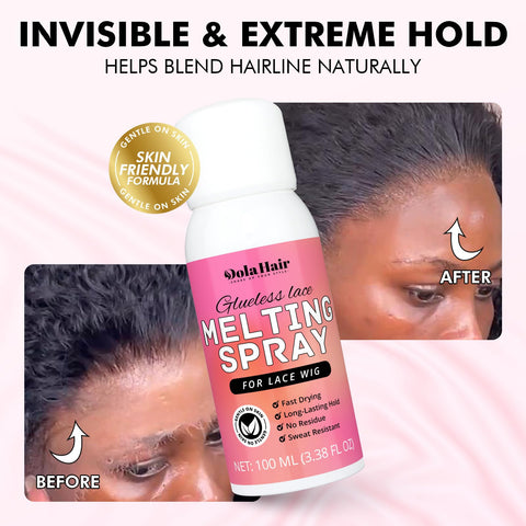 Lace Melting Spray For Glueless Wig Installs Stays Put Bonding Adhesive Wig Glue Spray For Smooth Natural Lace Blend With Your Skin Tone 1 Band And 1 Brush Included bottle with before and after hairline images