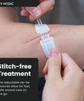 ZZips MedPack Wound Closure Kit For Cuts And Lacerations That Lets You Close Up Without Stitches Safe Skin Closure Without Surgery
