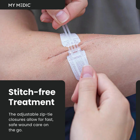 ZZips MedPack Wound Closure Kit For Cuts And Lacerations That Lets You Close Up Without Stitches Safe Skin Closure Without Surgery