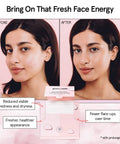 Before and after image depicting skin improvement using Ultra Soft Disposable Face Towels For Travel Essentials On The Go Extra Large Wipes