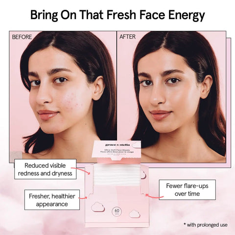 Before and after image depicting skin improvement using Ultra Soft Disposable Face Towels For Travel Essentials On The Go Extra Large Wipes