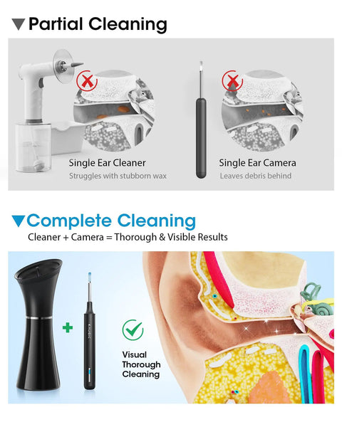 Easy At Home Ear Wax Removal Kit With Camera For Safe Gentle Ear Cleaning Visual Inspection Ear Camera And Gentle Irrigation System diagram