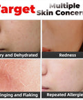 Image showcasing multiple skin concerns, including dryness, redness, flaking, and allergies for Hydration Packed Oxygen Facial Solution For Anti Aging And Glow Up Xylitol Nutrient Formula With Glycerin And Hyaluronic Locks Moisture And Forms Protective Film To Reduce Water Loss Spa Quality Home Facial Treatment.