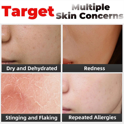 Image showcasing multiple skin concerns, including dryness, redness, flaking, and allergies for Hydration Packed Oxygen Facial Solution For Anti Aging And Glow Up Xylitol Nutrient Formula With Glycerin And Hyaluronic Locks Moisture And Forms Protective Film To Reduce Water Loss Spa Quality Home Facial Treatment.
