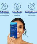 Smiling woman holding Acne Treatment Gel With 0.1 Percent Adapalene Retinoid, OTC Face Care, with benefits icons above.