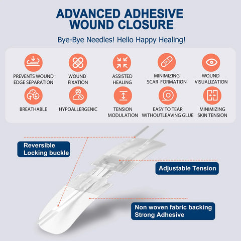 Advanced adhesive wound closure strips with nonwoven backing, reversible buckle, adjustable tension