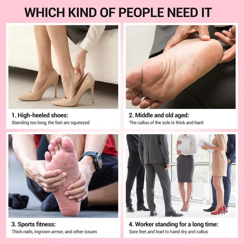 Image showing different scenarios where 60 Pcs Replacement Sandpaper Discs With 25mm Metal Mandrel Bit are needed for foot care.
