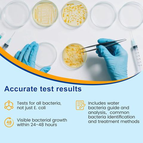 Hands using tweezers with culture plates testing bacteria for Drinking Water Bacteria Test Kit With 12 Tests Detecting Coliform And E Coli.