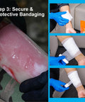 Rhino Rescue Burn Kit by Amazon: forearm burn dressing with blue nitrile gloves, applying bandage and tape.