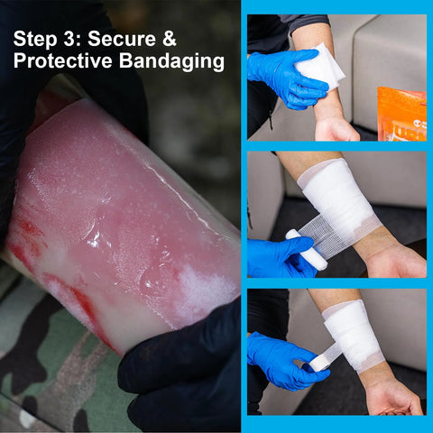Rhino Rescue Burn Kit by Amazon: forearm burn dressing with blue nitrile gloves, applying bandage and tape.