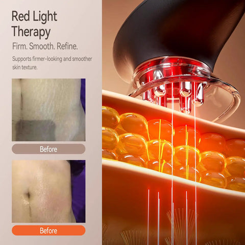 3-In-1 Body Sculpting Machine With Red Light Vacuum Suction And Microcurrent showing red light therapy effects on skin
