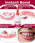 Instant Denture Glue For Loose Teeth And Cracked Dentures, Fast Bond In 15 To 60 Seconds, Lasts Days To Weeks, 1oz bottle