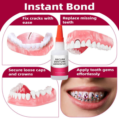Instant Denture Glue For Loose Teeth And Cracked Dentures, Fast Bond In 15 To 60 Seconds, Lasts Days To Weeks, 1oz bottle