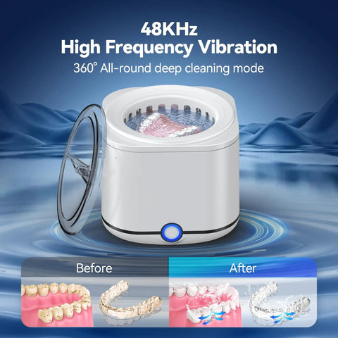 Ultrasonic Retainer Cleaner 48KHz High Frequency Cleaning Machine with 7.8 oz cool white pod, showing before and after cleaning results.