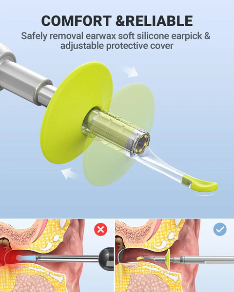 Digital Otoscope For iPhone And Android HD Ear Camera with silicone earpick and protective cover, ear wax removal details.