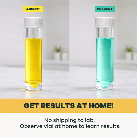 No Sweat At Home Bacteria Water Test Kit For Safe Drinking Water Screening detects absence and presence of E Coli in vials.