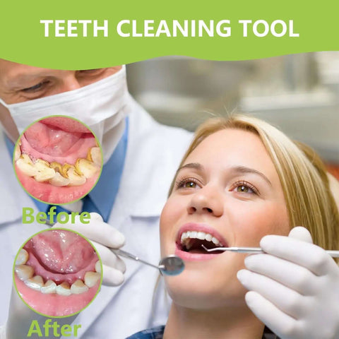 Pro At Home Dental Cleaning Kit With Stainless Steel Dental Pick And Tartar Remover used by a dentist, before and after results shown.