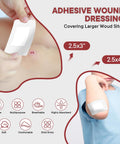 Close-up of adhesive wound dressing applied to forearm; two sizes 2.5x3 and 2.5x4 inches; sterile, breathable, absorbent bandage.