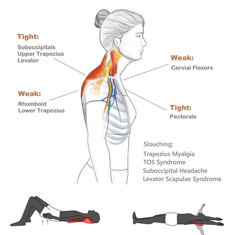Diagram of neck and shoulder muscle tightness and weakness with exercises for Trapezius Massager For Neck And Upper Back Pain Relief.