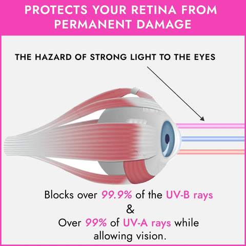 Eyeshields UV eye-protection goggles with white body and pink strap, front view.