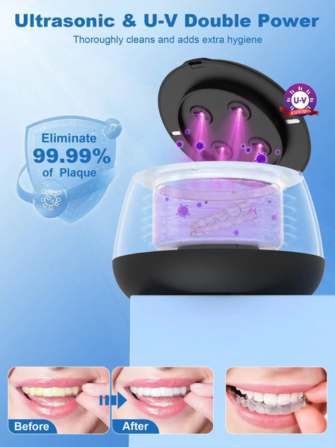 Upgrade Your Daily Oral Hygiene With This Hella Slick 48 Khz Ultrasonic Retainer Cleaner Machine cleaning aligners in a clear case.