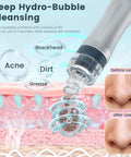 Illustration of At Home Pro Grade Hydro Facial System With Hydrogen Oxygen Therapy Hydrodermabrasion and pore cleansing.