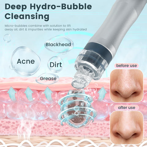 Illustration of At Home Pro Grade Hydro Facial System With Hydrogen Oxygen Therapy Hydrodermabrasion and pore cleansing.