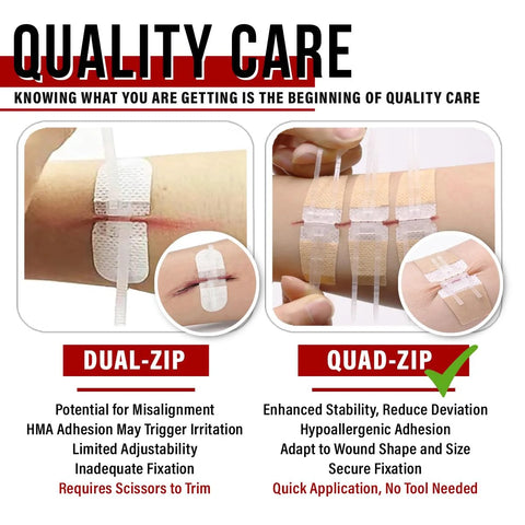 EVERLIT Wound Closure Kit: front view of zip-stitch adhesive bandages for cuts; white, suture-free first aid.