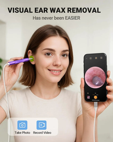 Video Ear Scope Camera For iPhone And Android Dope Ear Wax Removal Tool With Visual Ear Canal Inspection Share High Resolution Photos And Videos With Integrated LED Lighting For Clear Close Ups Real Time On Your Phone And Easy Sharing. Woman uses purple otoscope with phone display.
