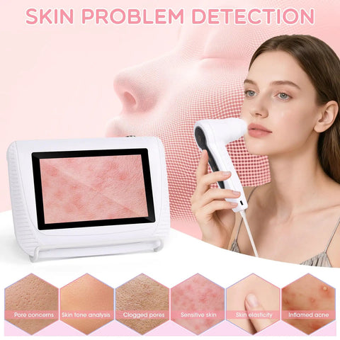 Woman using 5 Inch Digital Scalp Camera For Skin Health Analysis With 50x And 200x Lenses, showing skin close-up on screen.